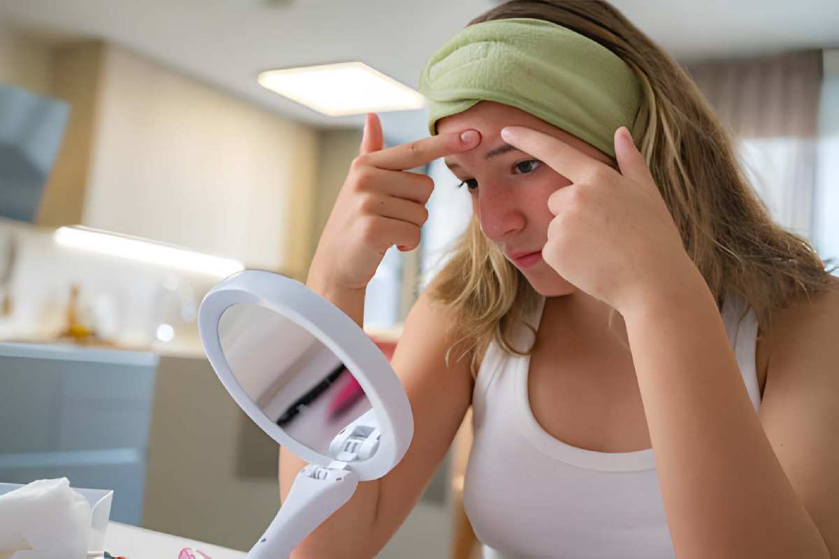 How to Get Rid of Pimples in 5 Minutes