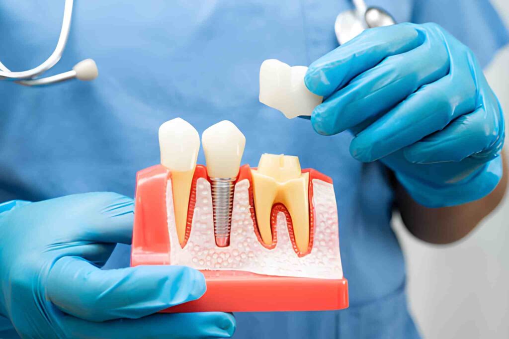 Dental Implants Near You in Royal Palm Beach